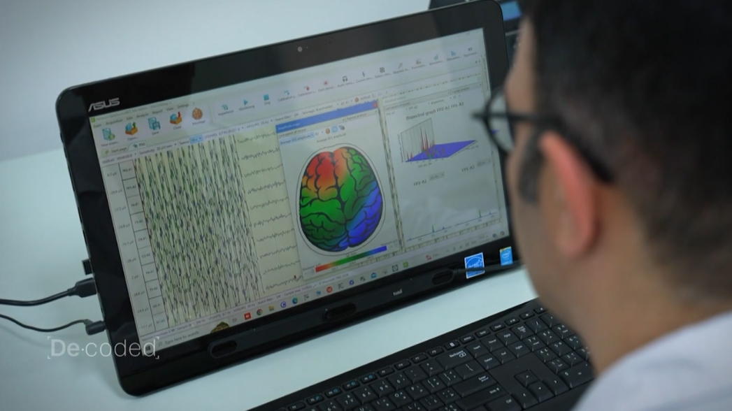 Image for How Brain-Computer Interface Technology Is Being Used To Improve Lives