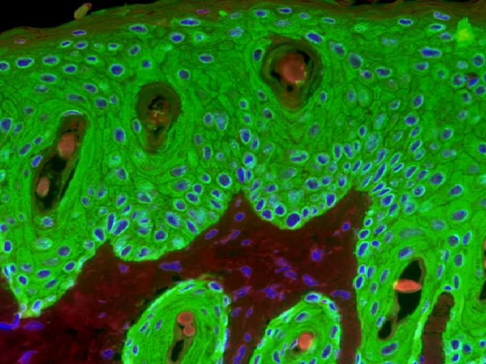 Japanese Researchers Develop Implanted ‘Lliving Skin’ That Glows To Signal Health Changes